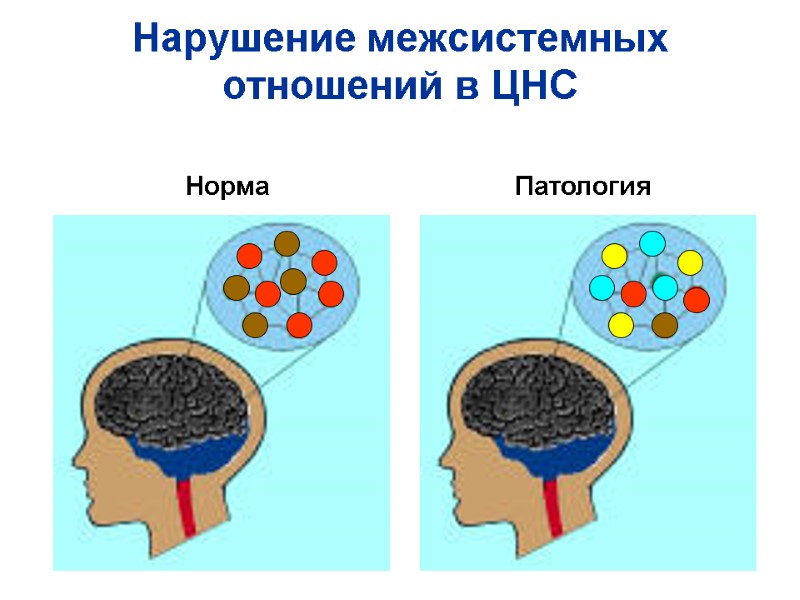 Нарушение межсистемных отношений в ЦНС Норма Патология